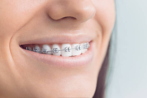 Best Dental Fillings (Composite and Amalgam)  in South Houston, TX